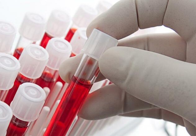 análise de sangue despois de beber alcol